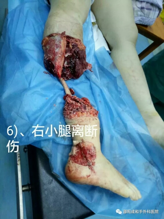 邵陽(yáng)創(chuàng)傷骨科,邵陽(yáng)風(fēng)濕病區(qū),邵陽(yáng)骨質(zhì)增生,邵陽(yáng)關(guān)節(jié)病區(qū),邵陽(yáng)頸椎病區(qū) 邵陽(yáng)創(chuàng)傷骨科,邵陽(yáng)風(fēng)濕病區(qū),邵陽(yáng)骨質(zhì)增生,邵陽(yáng)關(guān)節(jié)病區(qū),邵陽(yáng)頸椎病區(qū)
