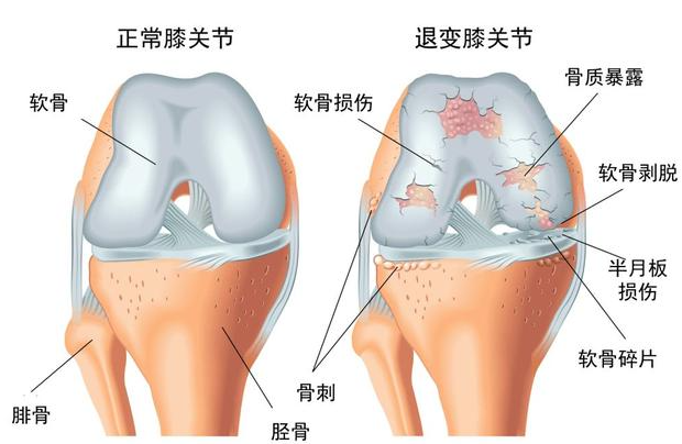 邵陽創(chuàng)傷骨科,邵陽風濕病區(qū),邵陽骨質(zhì)增生,邵陽關節(jié)病區(qū),邵陽頸椎病區(qū)