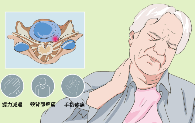 邵陽創(chuàng)傷骨科,邵陽風濕病區(qū),邵陽骨質(zhì)增生,邵陽關節(jié)病區(qū),邵陽頸椎病區(qū)