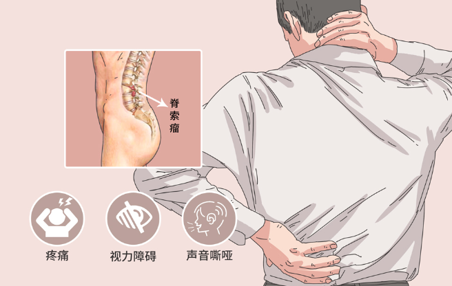 邵陽創(chuàng)傷骨科,邵陽風濕病區(qū),邵陽骨質(zhì)增生,邵陽關節(jié)病區(qū),邵陽頸椎病區(qū)
